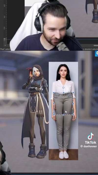 Blizzard can't in anatomic