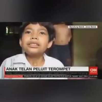 A child swallowed a whistle trumpet