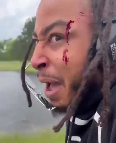 Coulda been his eye