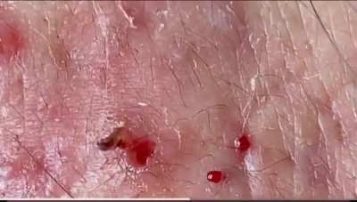 More chonky pops