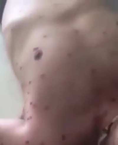 Attacking a swarm of bees