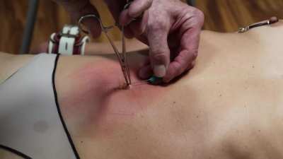 navel torture