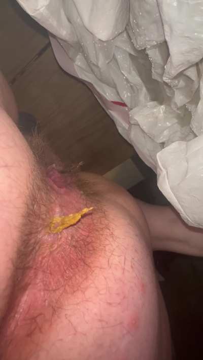 Wifey pushing out a big load, tried helping her shake off the little piece hanging on. Closeup of her gaped open pussy at end 😈