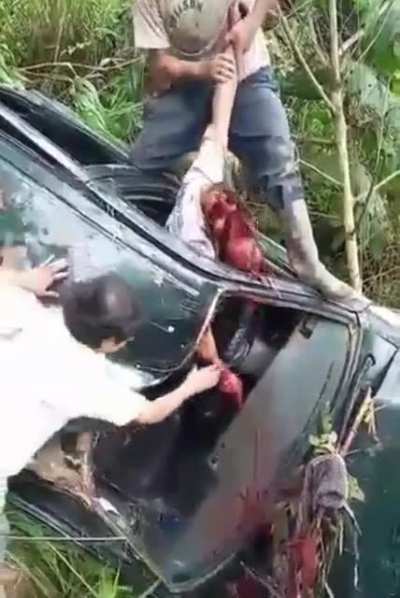 Nasty car crash leaves victim&rsquo;s skull and loose face hanging from remaining tissue.