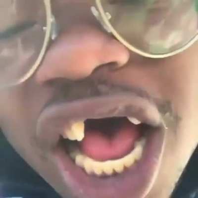 🦷&mdash;&mdash;&mdash;&mdash;&mdash;&mdash;🦷