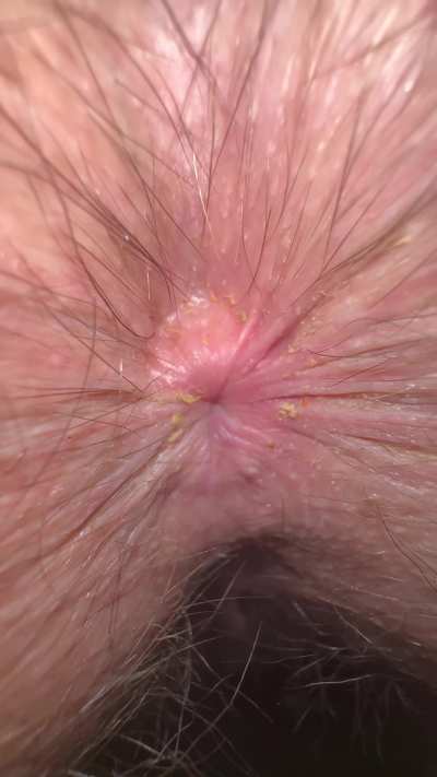 Wifey winking her dirty asshole 