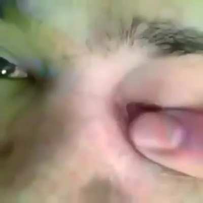 Zoomed in