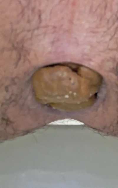 Look at this big load stretching up my butthole as it drops out