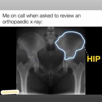 The X-ray don&rsquo;t lie