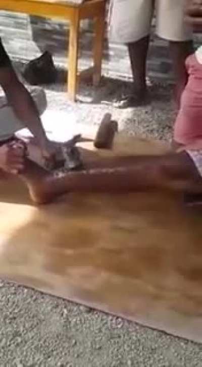 "Fixing" a broken tibia