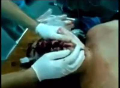 this is the video