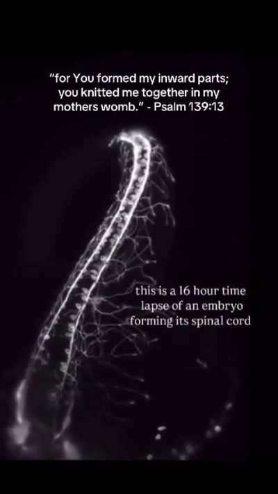 Reposting: Brittany reposts a Live Action (Lila Rose) post showing a "16 hour time lapse of an embryo forming its spinal cord." It's a zebra fish and not even an Human Embryo.