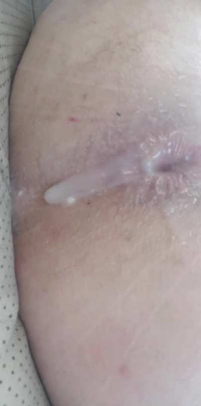 Anal Creampie dripping out with a gape from BBC🍑💦💦