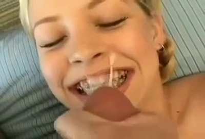 Brace face gets a load