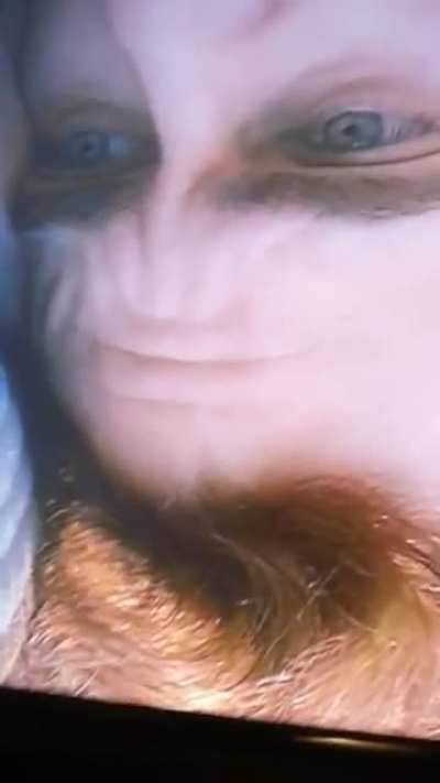 Joaquin Phoenix's Forehead (Rotated)