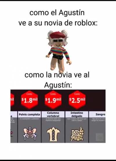 XD