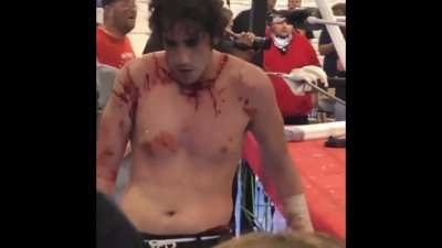 Caught that curb stomp in the neck.