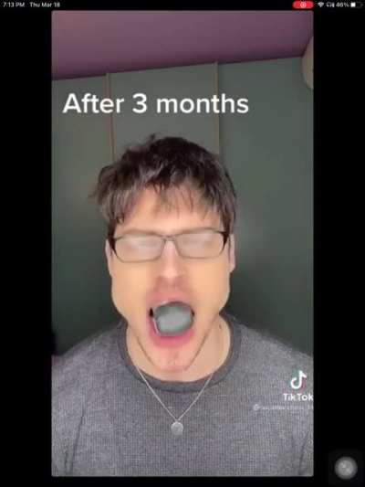 My man&rsquo;s chin looking like a dorito