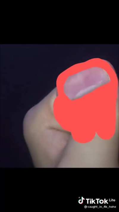 SUS