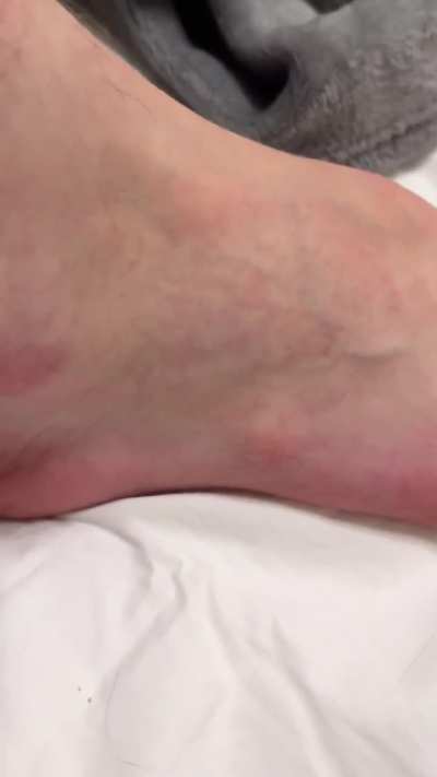 Why does my right foot &ldquo;pulsate&rdquo; like this sometimes?