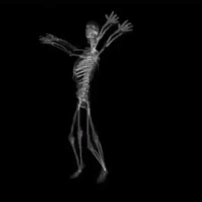 Skeleton