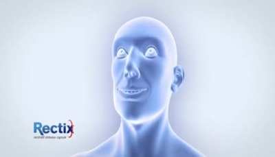 Rectix!!!