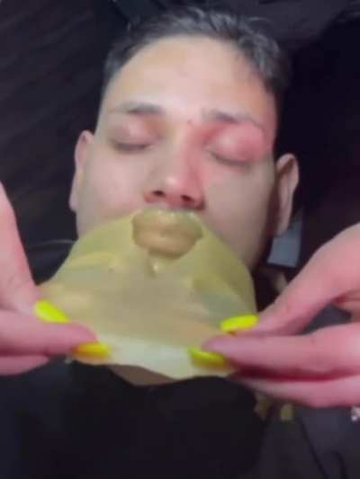 It peels it off the skin or else it gets the shrill