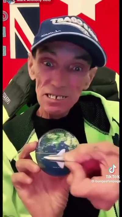 Bro don&rsquo;t believe in dental care either!