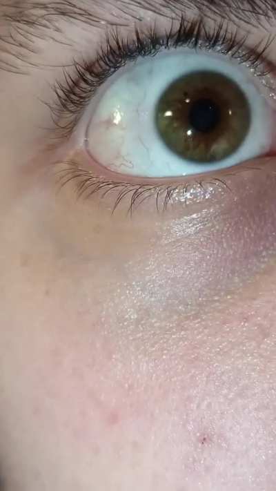 I can shake my eyes