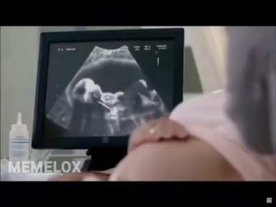 Ma&rsquo;am it&rsquo;s a boy!