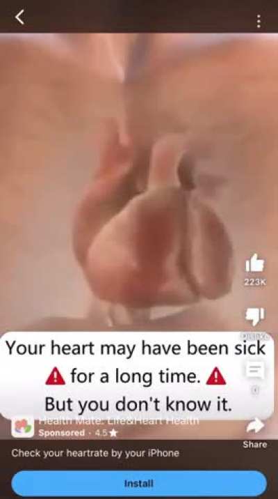 hart attacm