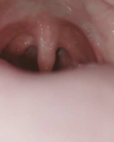 my long uvula lubricating my throat with saliva 😋