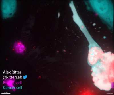 Killer T cell of the immune system destroying a monstrous ovarian cancer cell (Credit- Alex Ritter)