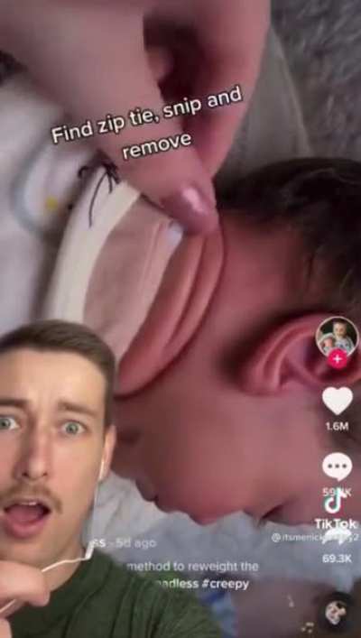 Ziptie around a baby&rsquo;s head?