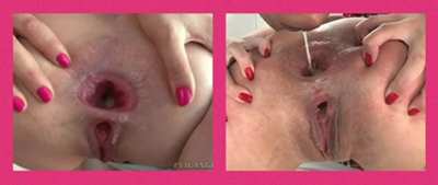 Attention Buttfuckers! Let&rsquo;s take a poll: What do you prefer, Cumfarts or Gapeshots?