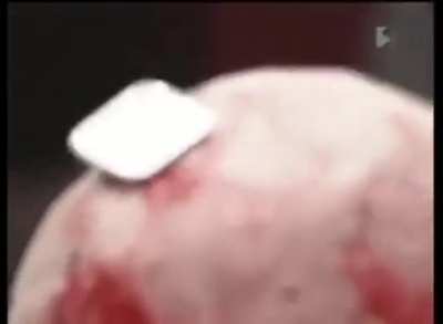 Context unknown, professional wrestler gets cpu smashed into head