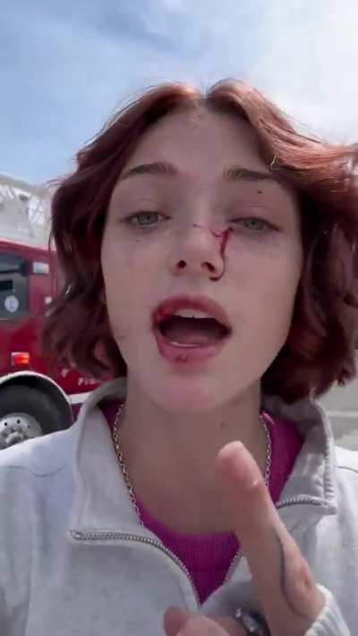 Shrooms Q gets hit by car 30 minutes after leaving City Hall to complain about a broken traffic light. [Source: X]