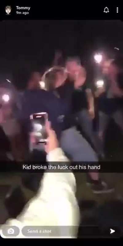 Snapped his wrist