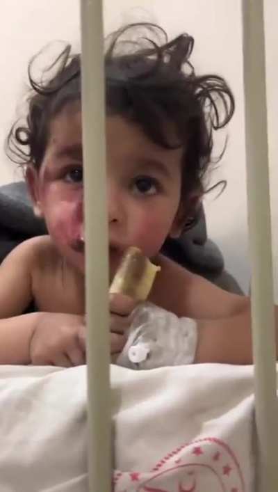 This child&rsquo;s entire family were killed in the earthquake in northan syria and by some miracle, she survived, but left an orphan, Born into a 12yr-old war &amp;amp; confronted with the ugly reality this world can represent, No more words.
