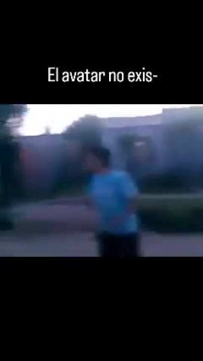 &iquest;No era calvo? 🤔