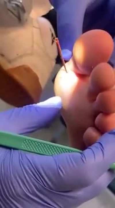Jake was complaining about a &ldquo;splinter&rdquo; in his foot&hellip;