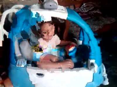 TURBO *se rompe la cara*