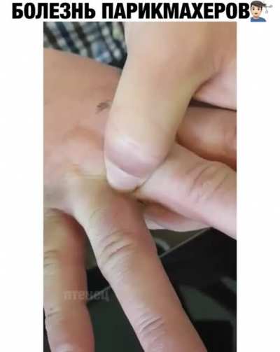 &ldquo;Hairdresser&rsquo;s disease&rdquo;