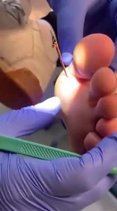 Jake was complaining about a &ldquo;splinter&rdquo; in his foot&hellip;