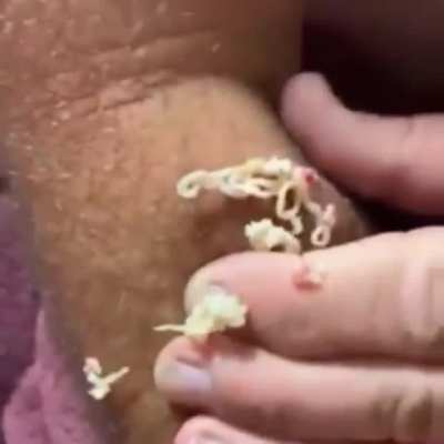 Cursed_cyst