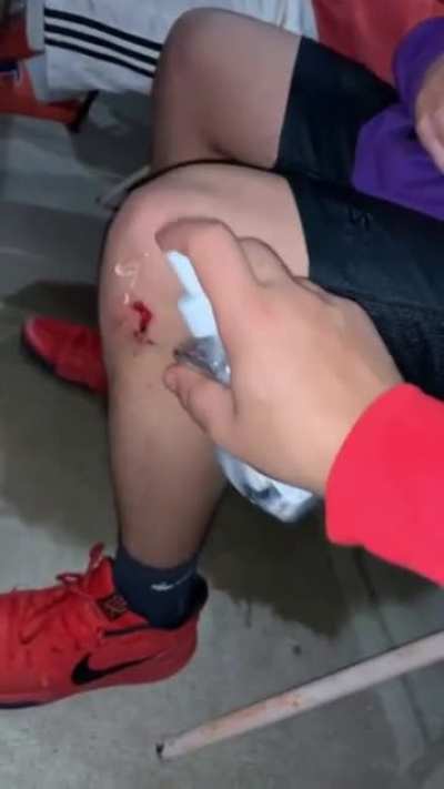 Need to clean the wound man..