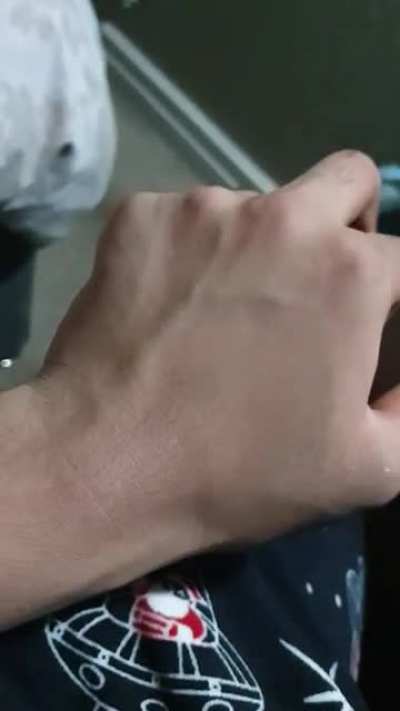 guys I think I can move my vein is this normal?.is this dangerous?