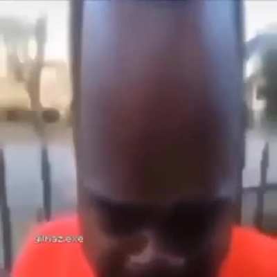 forehead