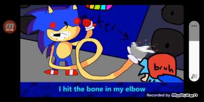 BONE IN HIS ELBOW