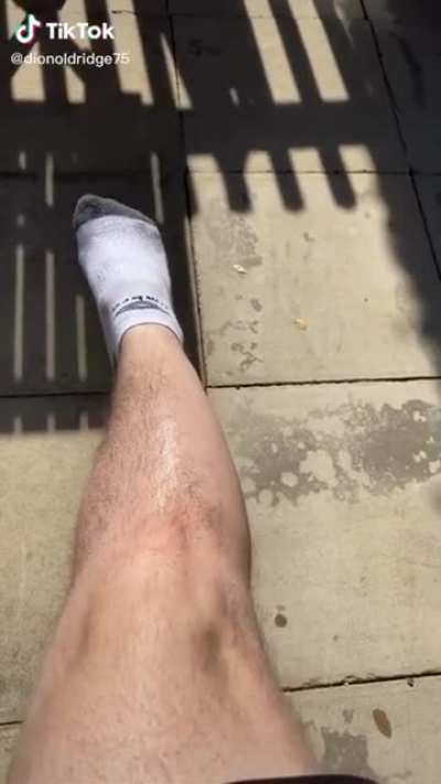 Sun Bathing